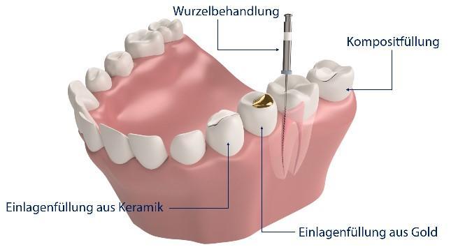 Die beste Zahnzusatzversicherung&nbsp;ist diejenige, die am besten zu Ihnen passt